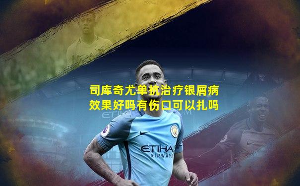 司库奇尤单抗治疗银屑病效果好吗有伤口可以扎吗